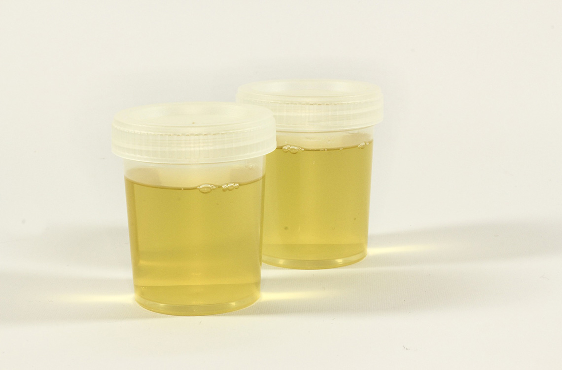 Urine DOT and non-DOT Drug Testing